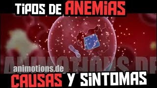 QUE ES LA ANEMIA  TIPOS SINTOMAS CAUSAS Y TRATAMIENTO [upl. by Aliban]