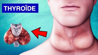 Glande Thyroïde  Pathologies Symptômes et Traitements [upl. by Chelsy643]