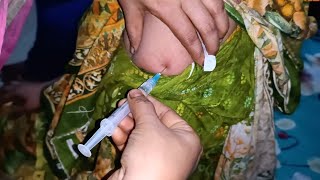 IM Intramuscular Arm injection Push Dexamethasone injection Video 24 Ep 29 Anik Health Tips [upl. by Alyat]