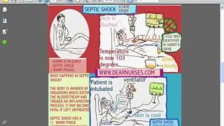 SESSIONS for NURSES 10  CARDIOGENIC AND SEPTIC SHOCK [upl. by Massimo]