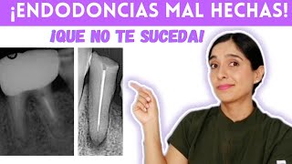 🚩🚩¡ENDODONCIAS MAL HECHAS  RED FLAGS EN ENDODONCIA ¡QUE NO TE SUCEDA 🚩🚩 [upl. by Pillsbury]