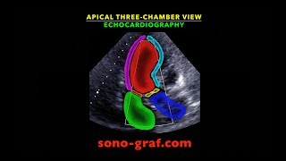 Echocardiography  Apical three chamber view [upl. by Ellehcram673]