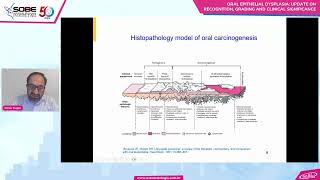 Oral epithelial dysplasia update on recognition grading and clinical significance [upl. by Odlamur41]