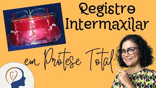 Registro Intermaxilar [upl. by Carmelita]