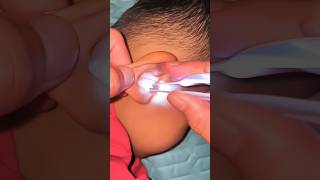 Led Ear Cleaner Tool  Best Amazon Product 🔥shorts shortsfeed viralvideo [upl. by Horton]