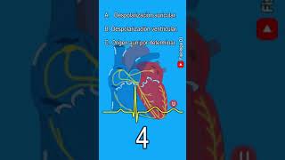 Electrocardiograma interpretación  ¿Qué origina la onda U en el trazo del electrocardiograma [upl. by Bergquist838]