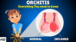 Orchitis – Types Causes Signs and Symptoms Diagnosis amp Treatment [upl. by Greenberg363]