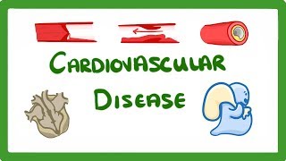 GCSE Biology  Why Do We Get Heart Disease and How to Treat It  Cardiovascular Disease CVD 47 [upl. by Teagan]