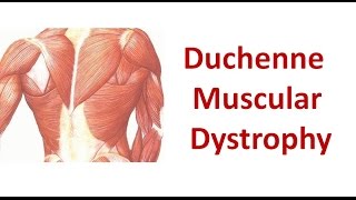 Duchenne Muscular Dystrophy [upl. by Levana611]