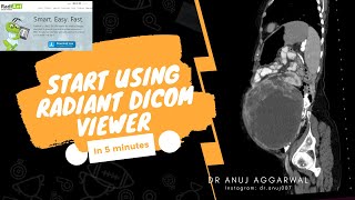 How to use RADIANT Dicom viewer I Radiology Basics I Dr Anuj Aggarwal [upl. by Alger]