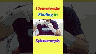 What is the characteristic finding in splenomegaly shorts spleen splenomegaly anatomy [upl. by Jasmina635]