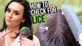 How to Check for Lice  5 Lice Treatment Tips from a Professional [upl. by Annazor367]