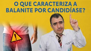 O que caracteriza a balanite por candidíase [upl. by Oihsoy412]