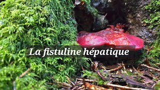 La fistuline hépatique [upl. by Gerg]