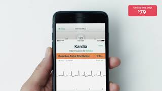 KardiaMobile by AliveCor  79 Limited Time Offer [upl. by Tabitha458]