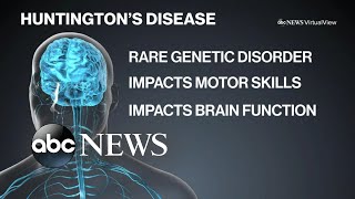 Living with Huntington’s disease [upl. by Mic]