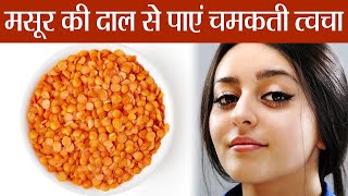 Masoor Dal for Skin Beauty मसूर की दाल से पाएं चेहरे पर गज़ब का निखार  Boldsky [upl. by Sobel]