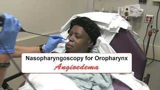 Emergency Nasopharyngoscopy for Angioedema Evaluation [upl. by Rosenberger992]