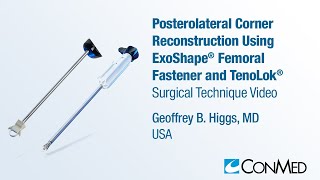 Dr Geoffrey B Higgs  PLC Reconstruction Using ExoShape® and TenoLok®  CONMED Technique [upl. by Nivert]