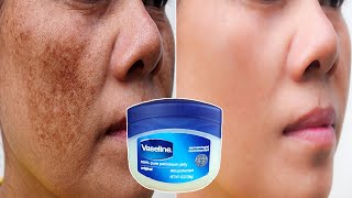 Voici Comment Utiliser La Vaseline amp Le Citron Pour Enlever Les Rides amp Les Taches Brunes De La Peau [upl. by Oiludbo]