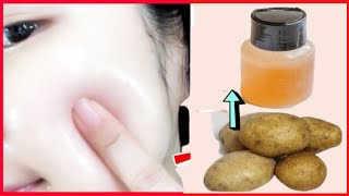 Homemade Face Wash For Face Whitening Removes Suntan Dark Spots Pimples  DIY Face Wash [upl. by Kaslik]