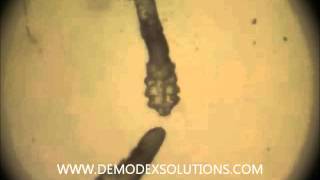 Demodex Brevis and demodex Folliculorum mite [upl. by Tolland335]