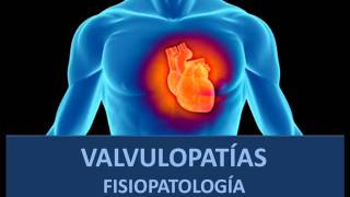 Valvulopatías  Fisiopatología [upl. by Lanctot]