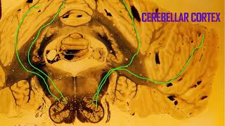 Purkinje cells in the cerebellum [upl. by Atiuqehs170]