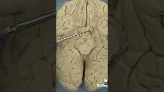 Parahippocampal gyrus uncusanatomyneuroanatomy cerebrumbraincortextemporallobelimbicsystem [upl. by Potash416]