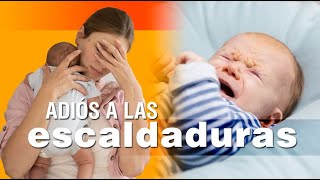 Las escaldaduras en los bebés  síntomas causas y soluciones [upl. by Aaberg]