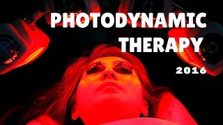 Photodynamic therapy [upl. by Inilam]