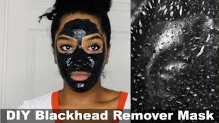 DIY Blackhead Remover Peel Off Mask  Removes EVERYTHING [upl. by Luby]