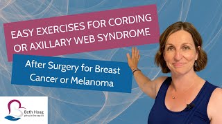 Easy exercises for axillary web syndrome or cording [upl. by Gareri211]