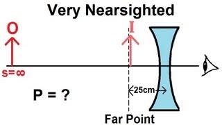 Physics  Optics Vision Correction 3 of 5 Very Nearsighted [upl. by Dachy25]