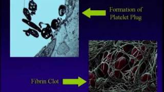 Part 2  Everything You Wanted to Know About Blood Clots  Stop the Clot Forum [upl. by Ardel462]