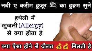 हथेली में खुजली का मतलब  Nabi e kareem huzoor ﷺ ne farmaya  ये शिर्क है  Allergy in palm  ﷺ [upl. by Crawford]