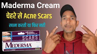 Maderma Advance Scar Gel Review  How To Use Maderma Cream  Maderma For Acne Scars [upl. by Egbert]