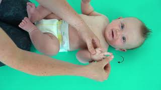 Baby Development  Erbs Palsy  Hand Massage [upl. by Eiramoj]