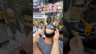 protezsaç değişim hair barbershop barber sackesimi hairstyle sacekimiistanbul protezsac [upl. by Eitak]