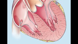 VALORHCM Shows Promise for Patients With Hypertrophic Cardiomyopathy for Healthcare Professionals [upl. by Sanoj222]