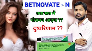 Betnovate n Cream honest review  Betnovate n lagane se kya hota hai  Betnovate n skin cream  aqh [upl. by Ardnoid]