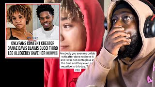 GucciThirdLeg Gave Danae amp Other Influencers HERPES [upl. by Cofsky918]