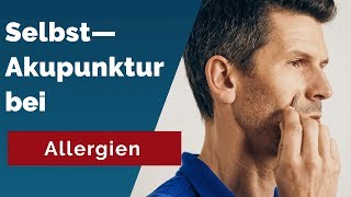 Stoppe Allergien Entdecke Akupunkturpunkte für schnelle Linderung [upl. by Anitsirc]