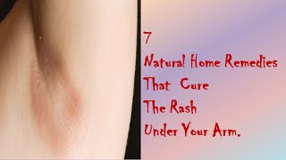 7 Natural Home Remedies That Cure The Rash Under Your Arm [upl. by Eilatam]