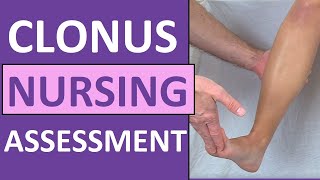 Clonus Test Positive Reflex Sign Preeclampsia Pregnancy  Nursing Skills [upl. by Reisman]