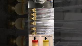 Indole Test biochemical test microbiology [upl. by Alroi]