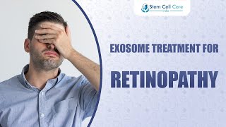 Exosome Treatment For Retinopathy  Stem Cells  Retinopathy  Eye Problem  Cell Regeneration [upl. by Eittol]