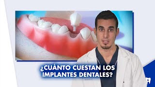 Precio de los IMPLANTES dentales  ¿Cuánto cuestan  Shorts [upl. by Etnuahs]