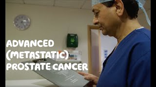 About Advanced Metastatic Prostate Cancer [upl. by Saltzman]