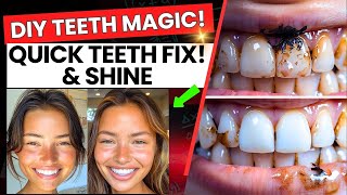 Fast Teeth Whitening Hacks You Can Do at Home Yellow Teeth to White 🦷 [upl. by Madelena]